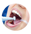 پر کردن دندان - دکتر حیدری