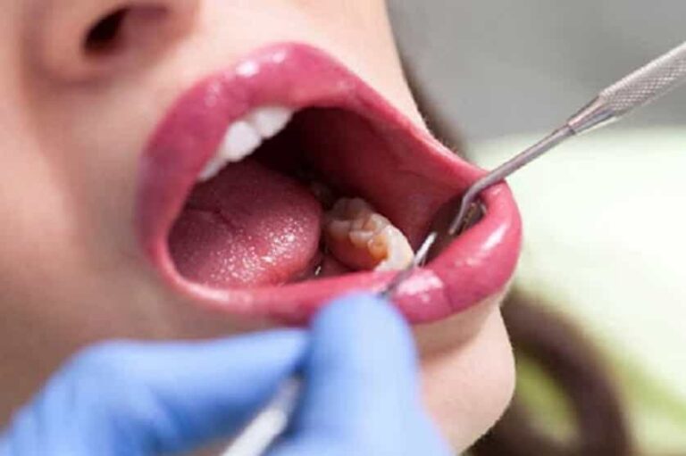 جراحی دندان - دکتر حیدری