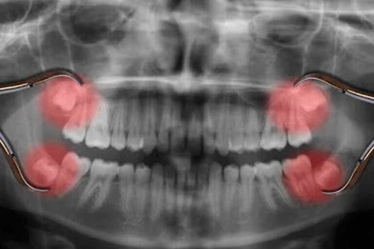جراحی دندان پیشرفته - دکتر حیدری