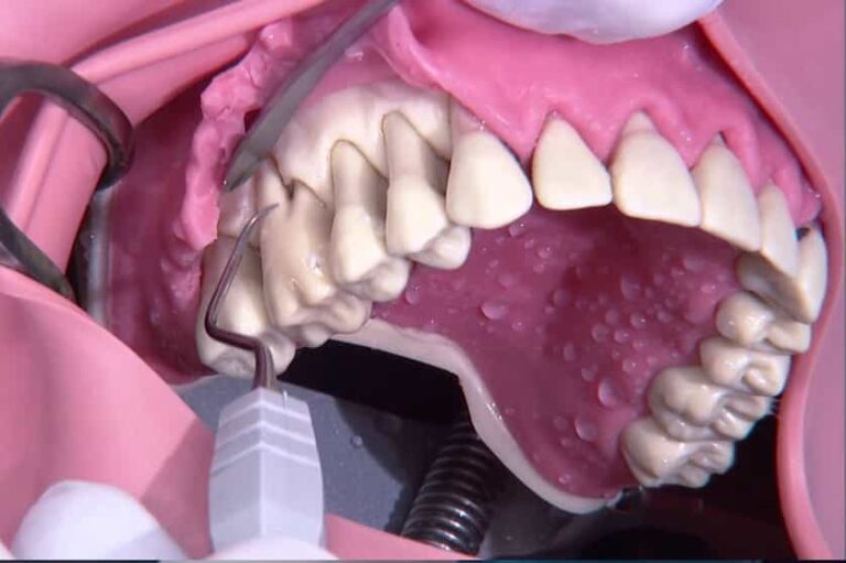 جراحی دندان پیشرفته - دکتر حیدری