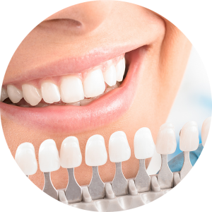 teeth-whitening-chart-spd-300x300-1