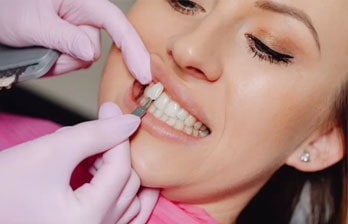 عوارض و محدودیت‌های لمینیت دندان